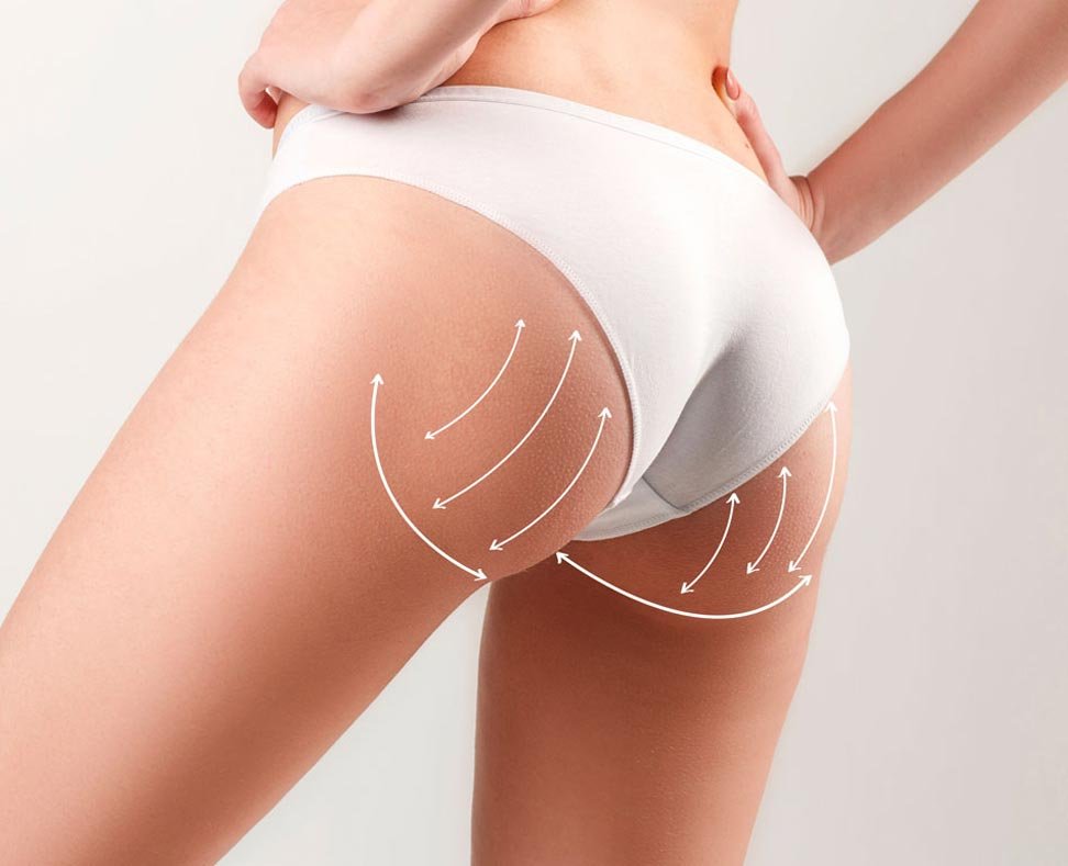 Chirurgie fessses Tunisie